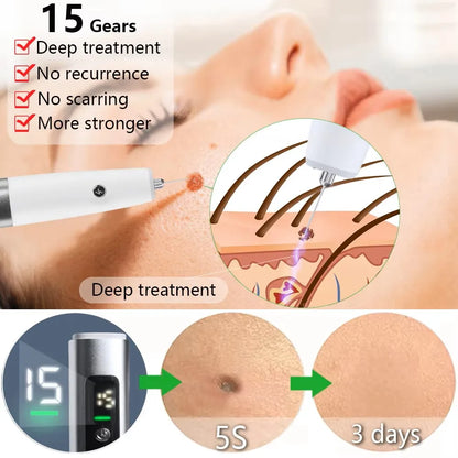 PlasmaSkin™